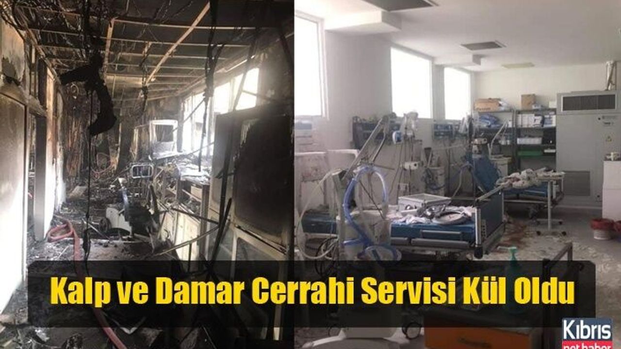 Kalp ve Damar Cerrahi Servisi Kül Oldu