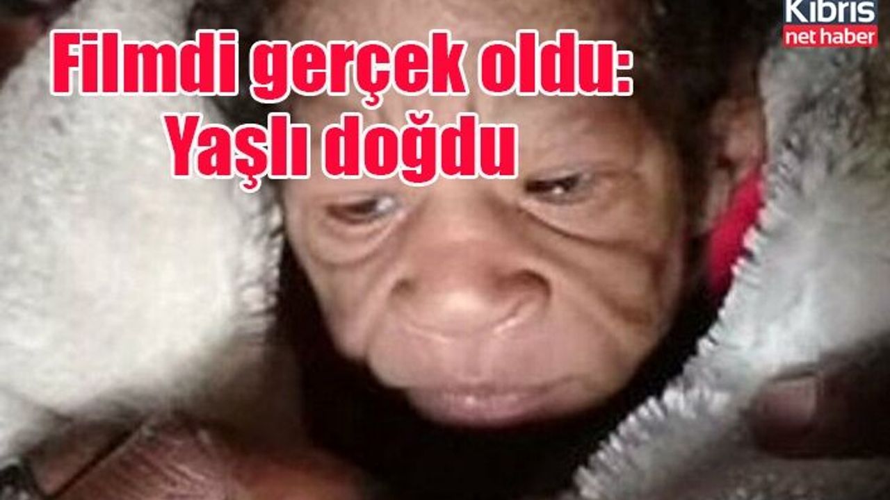 'Benjamin Button' filmi gerçek oldu: Yaşlı doğdu