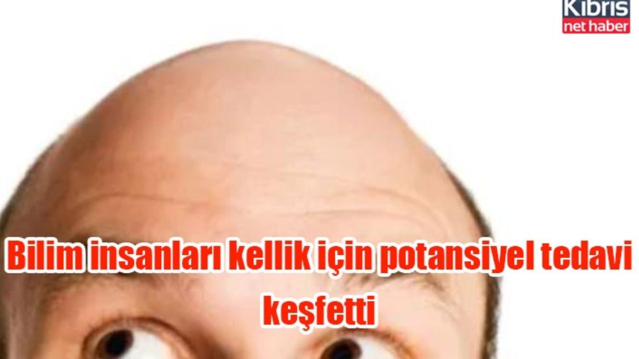 Bilim insanları kellik için potansiyel tedavi keşfetti