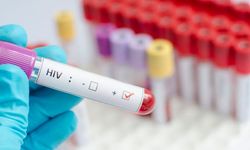 Tabipleri Birliği: HIV şüphesi olan her bireyin sağlık sistemine güvenle erişim hakkı sağlanmalı