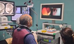 Gazimağusa Devlet Hastanesi’nde Kolanjioskopi dönemi başladı