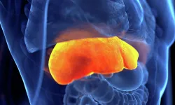 Metabolik karaciğer hastalığı alarm veriyor: 2050'ye kadar 1,8 milyar kişi risk altında