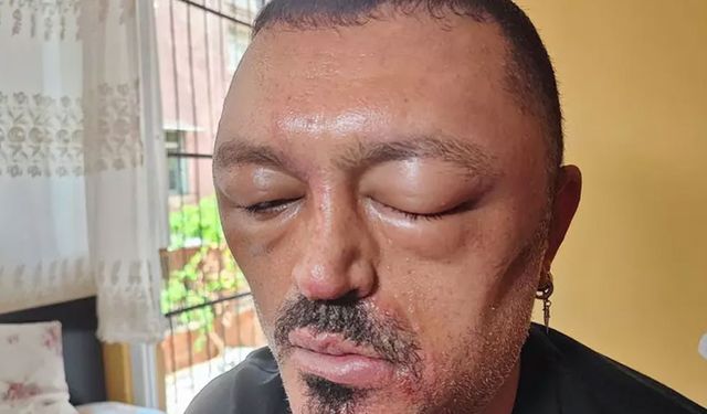 Sipariş verdiği şampuan bakın ne hale getirdi