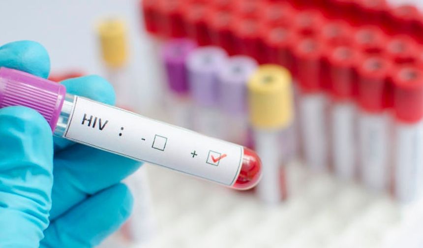 Tabipleri Birliği: HIV şüphesi olan her bireyin sağlık sistemine güvenle erişim hakkı sağlanmalı